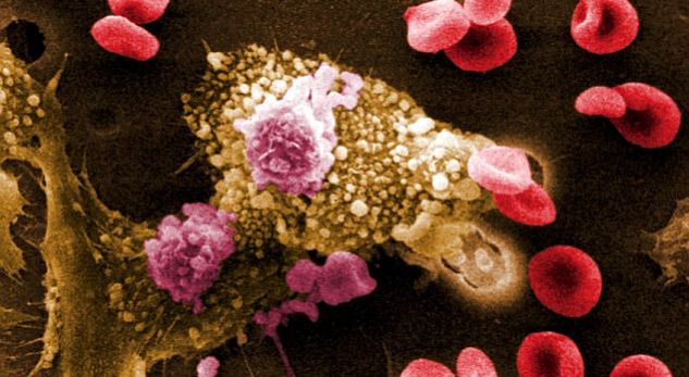 Zbulohet vaksina që ul kolesterolin e keq