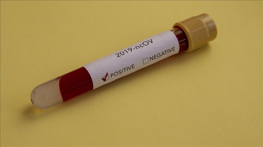 Infektohet nga koronavirusi një shtetas i Malit të Zi