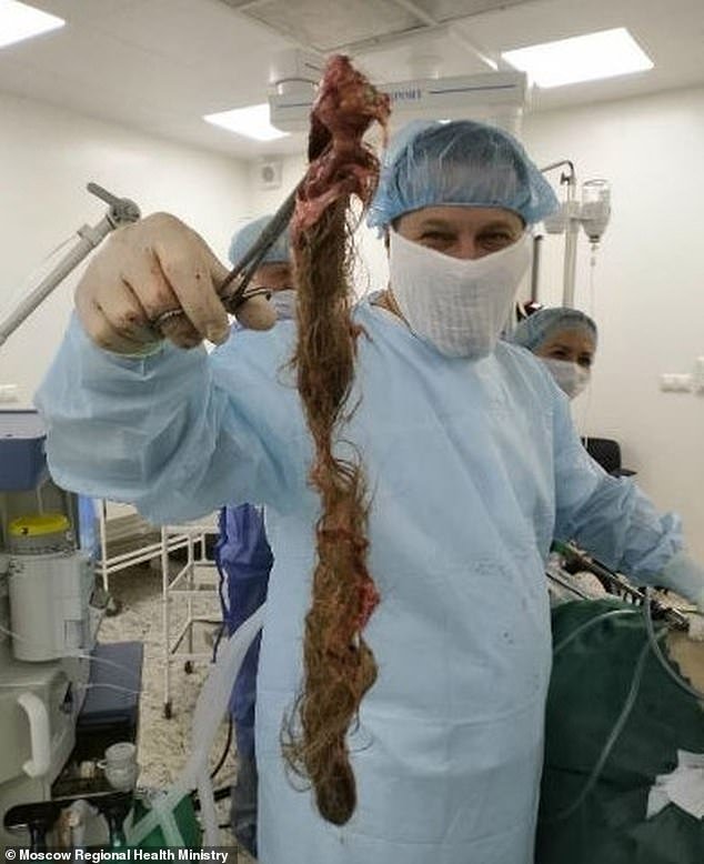 Kishte dhimbje të forta barku, gruas i zbulohen kiste me qime në vezore