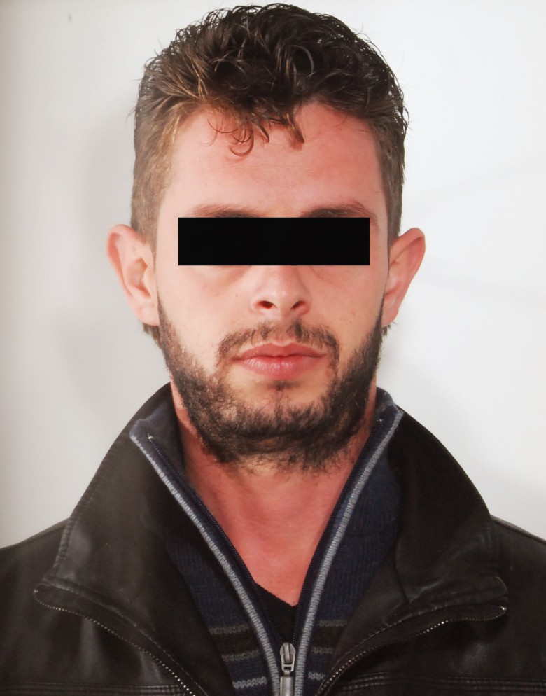 EMRI/ Qëlloi me armë drejt policisë italiane, lihet në burg 29-vjeçari shqiptar