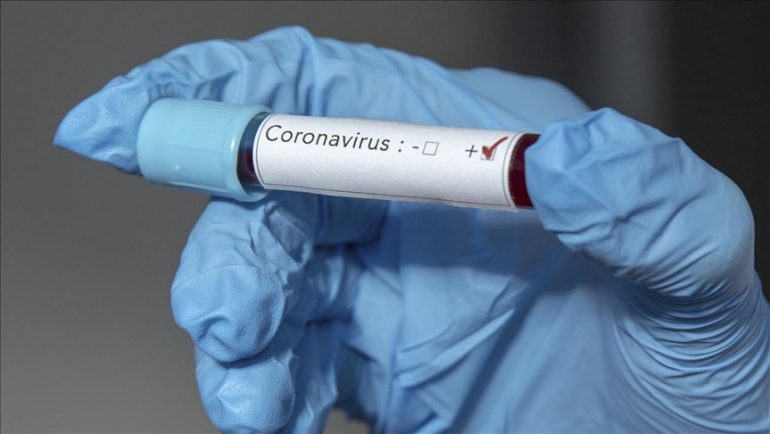 Ish-ambasadori iranian në Vatikan humb jetën nga koronavirusi