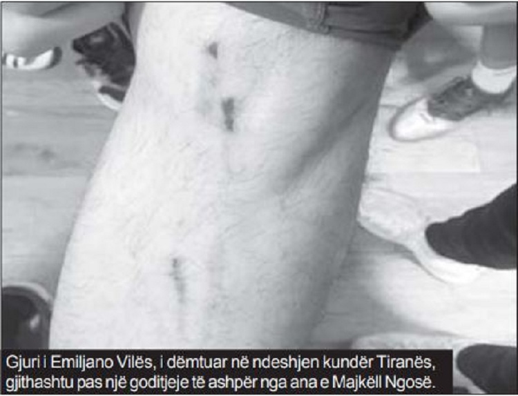 Vila tregon plagët pas një goditjeje të ashpër nga Ngo, Teuta rigjen kapitenin Arapi