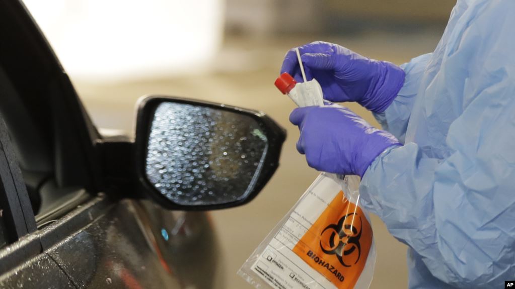 Arrin në 113 numri i viktimave nga koronavirusi në ShBA