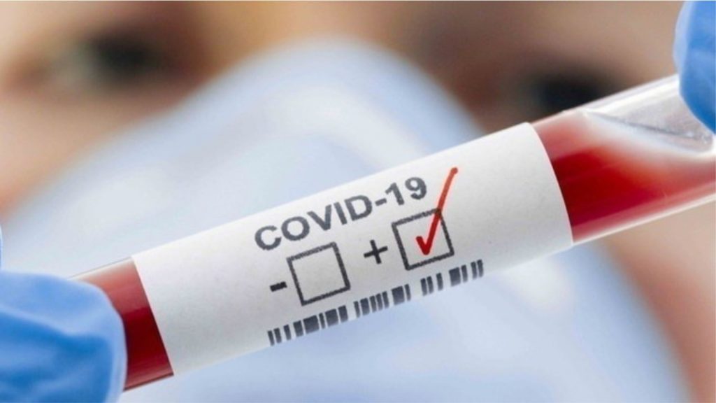 21 viktima dhe 947 të prekur me koronavirus në Turqi