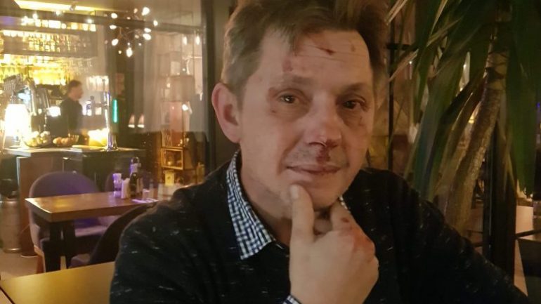 Rrihet brutalisht nga 5 veta kryeredaktori i RTK-së, ngjarja në një lokal të Prishtinës