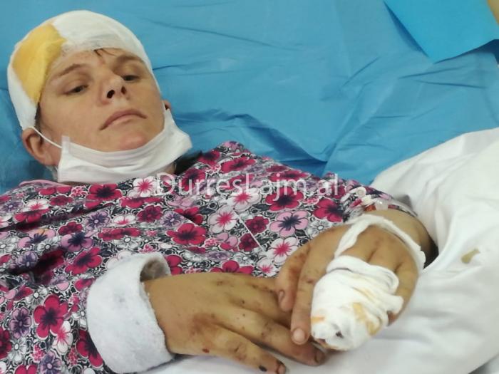 “Më goditi me lopatë, pastaj më mbuloi më gurë”, nëna e 5 vajzave rrëfen dhunën barbare nga burri (PAMJE TË RËNDA)