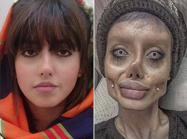 Kopja e shpërfytyruar e Angelina Jolie e burgosur, vendoset në ventilator nga gjendja e rëndë me COVID-19