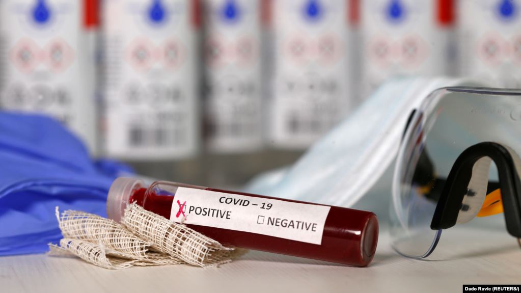 Italia me “pasaporta imuniteti”, çfarë nënkupton sistemi që mund të vihet në zbatim kur të hiqen masat kufizuese ndaj koronavirusit