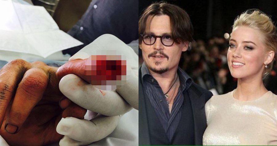 “Nuk po gjej gishtin!” Audio horror pas sherrit të aktorit Johnny Depp me ish-bashkëshorten (VIDEO)