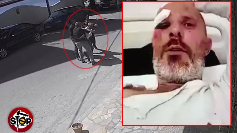 Dhunë barbare në mes të qytetit…