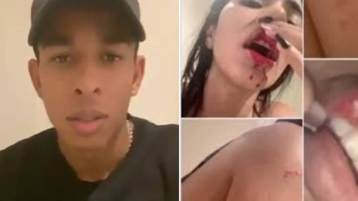 Pamjet të rënda, futbollisti 23-vjeçar dhunon barbarisht të dashurën