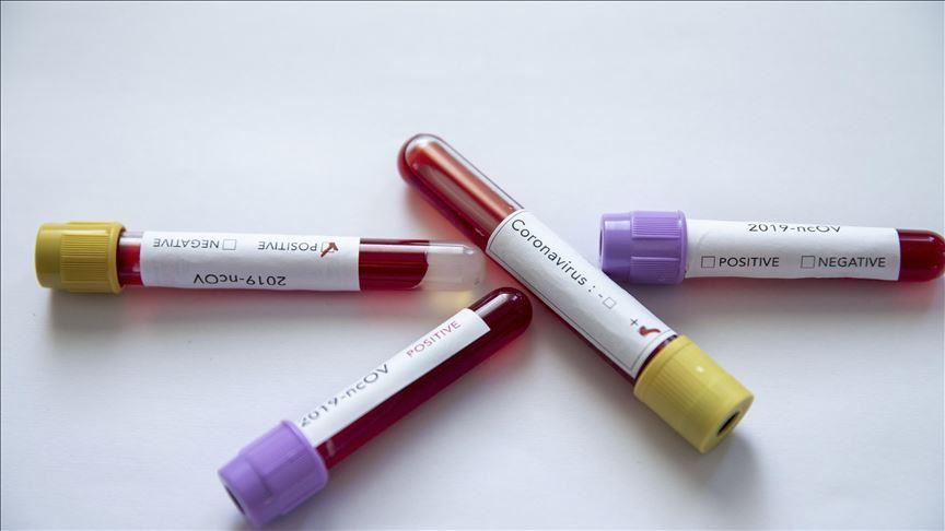 Covid-19/ Shkon mbi 1 mijë të vdekur numri i viktimave në Brazil