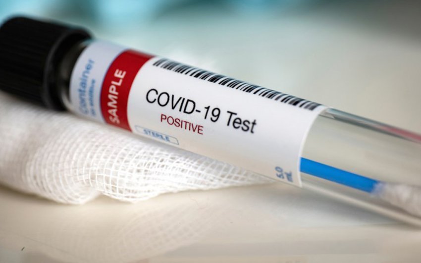 Infermierja rezulton 8 herë pozitive me koronavirus