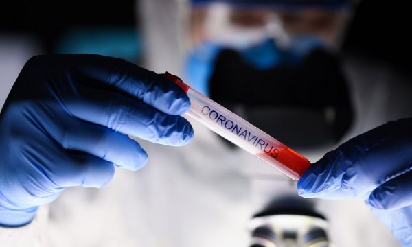 6 raste të reja me koronavirus në Kosovë, shërohen dy pacientë të tjerë