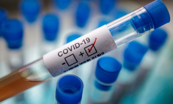 Vetëm 1 rast i ri me koronavirus në Kosovë