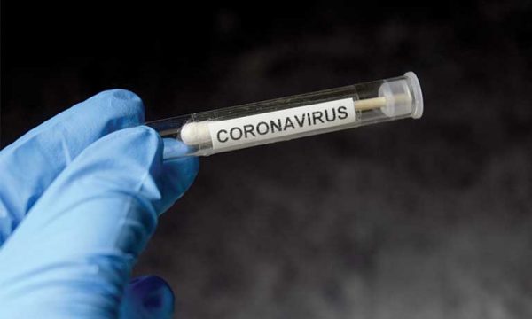 9 raste të reja me koronavirus në Kosovë