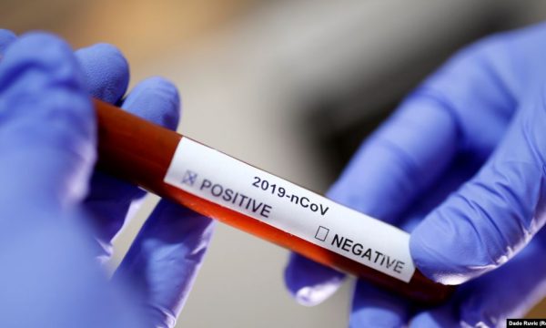 Katër gra shtatzëna dyshohet të jenë me COVID-19 në maternitetin e Prishtinës