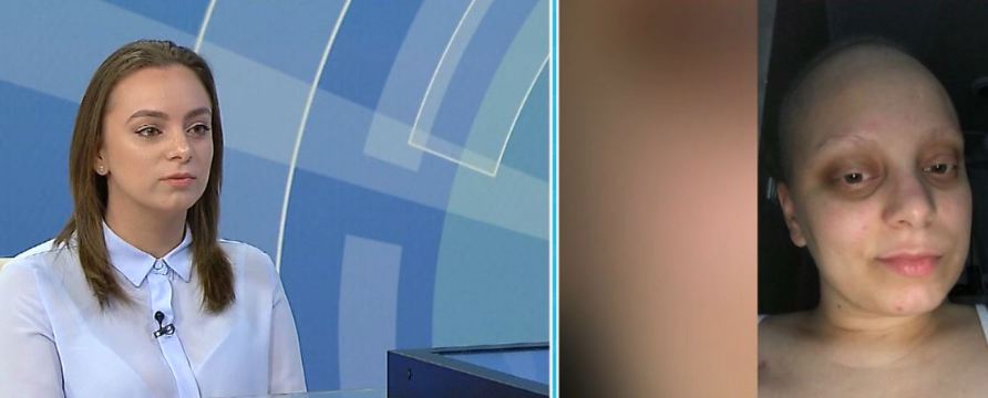 Rrëfimi drithërues i 24-vjeçares që mposhti kancerin e gjirit: E dallova në dush, kam qenë e fortë