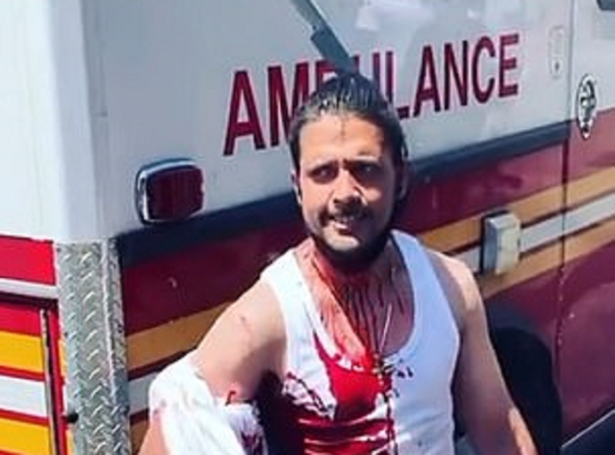 Momenti shokues kur burri ecën në rrugë me thikën e ngulur në kokë (VIDEO)