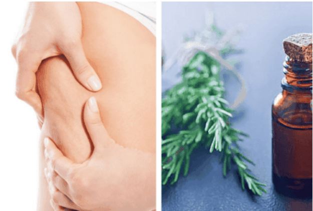 Si ta trajtoni celulitin me këtë përzierje natyrale