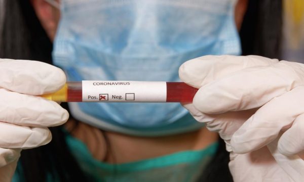 34 viktima nga koronavirusi në Itali, në 8 rajone asnjë rast i ri