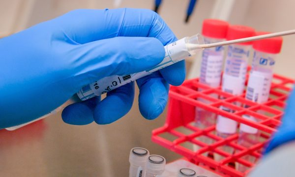 69 raste të reja me koronavirus në Kosovë, shërohen 75 pacientë