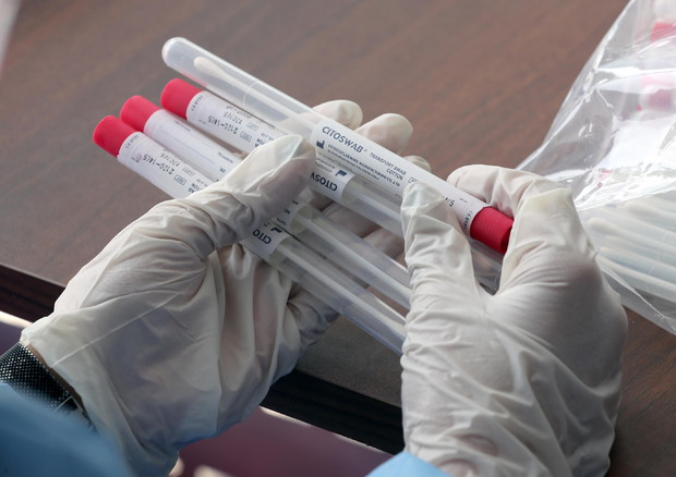 43 viktima, por rritet numri i rasteve të reja me koronavirus në Itali