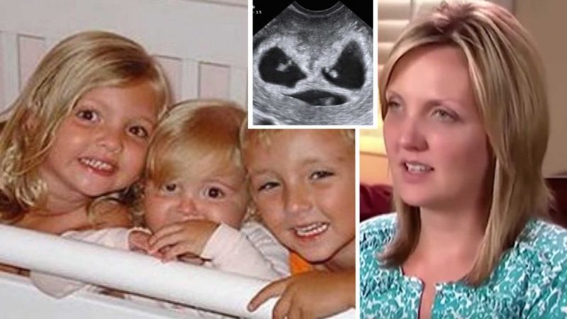 Historia e pabesueshme: Humbën tre fëmijët në aksident, çifti bëhet me trinjakë pas një viti