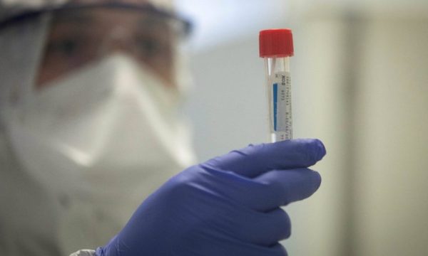 Një punonjës rezulton pozitiv me koronavirus, mbyllet drejtoria e Sigurimeve Shoqërore