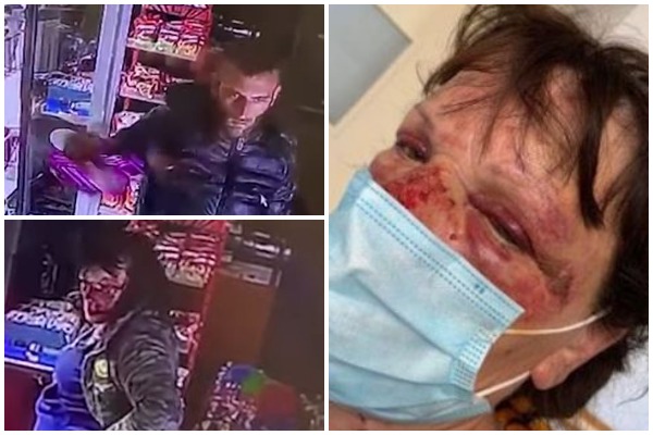 Shitësja në Durrës rrëfen momentin e dhunimit nga dy të rinj: Më goditën me gërshërë në gjoks e bark