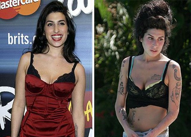 9 vite pa Amy Winehouse, si u shkatërrua nga droga ylli i muzikës