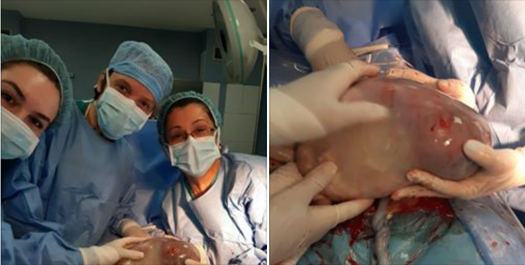 Emocionuese, lind fëmija me këmishë në maternitetin &#8220;Koço Gliozheni&#8221;