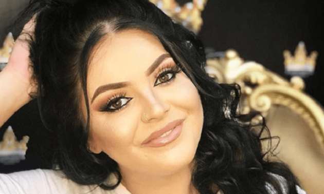 Fifi përfshihet në një aksident në Tiranë