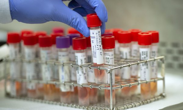 114 raste të reja me koronavirus në Kosovë