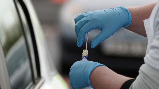 “Covid-19 nuk do të largohet”, studiuesit: Bota po përpiqet të funksionojë me praninë e tij