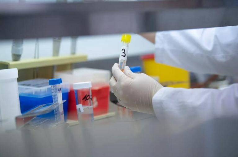 10 viktima dhe 409 raste të reja nga koronavirusi në Serbi