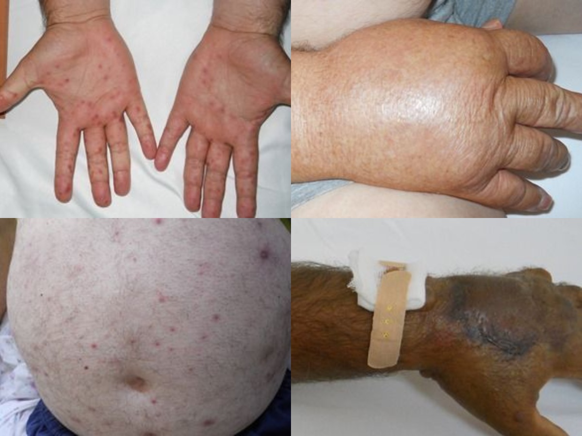 Tritan Kalo nxjerr pamjet e rënda: Mos u fokusoni vetëm te Covid-19, ka shumë infeksione…