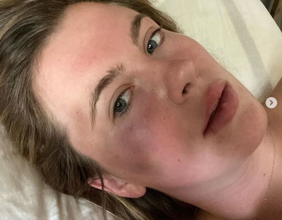 Modelja dhe aktorja e njohur rrihet në parking, tregon fytyrën e nxirë (FOTO)