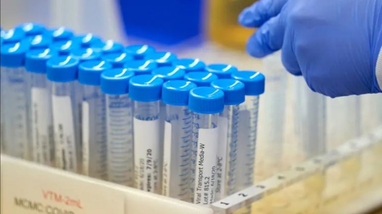 Jeni prekur nga koronavirusi? Ja deri kur mund të zgjasë imuniteti