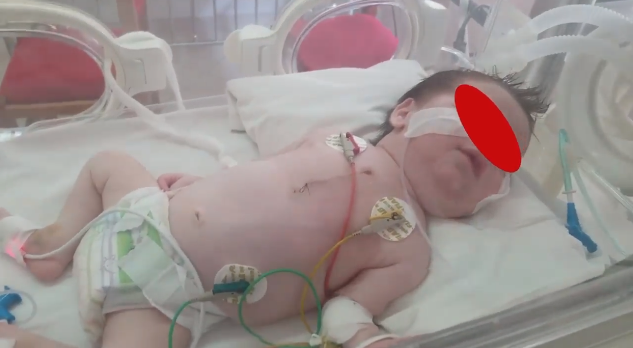 Realizohet me sukses në QSUT ndërhyrja në zemër tek bebi 12-ditësh (VIDEO)