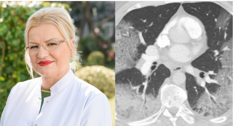 Mjekja publikon mushkëritë e pacientit dhe shpërthen: Kush jeni ju more palaço ordinerë që s’besoni te koronavirusi!