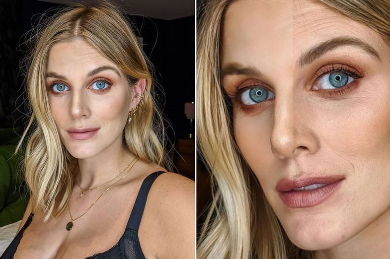 Blogerja thotë se filtrat e Instagramit kanë ndikuar negativisht në shëndetin e saj mendor