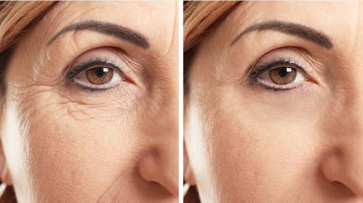 Faktorët që ju shtojnë rrudhat në lëkurë