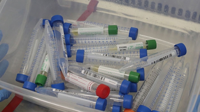 5 viktima nga Covid-19 në Maqedoninë e Veriut, rritet ndjeshëm numri i të infektuarve