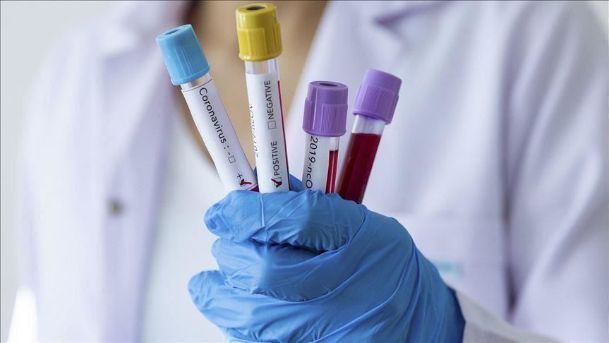 Covid-19 në Kosovë, asnjë viktimë në 24 orët e fundit