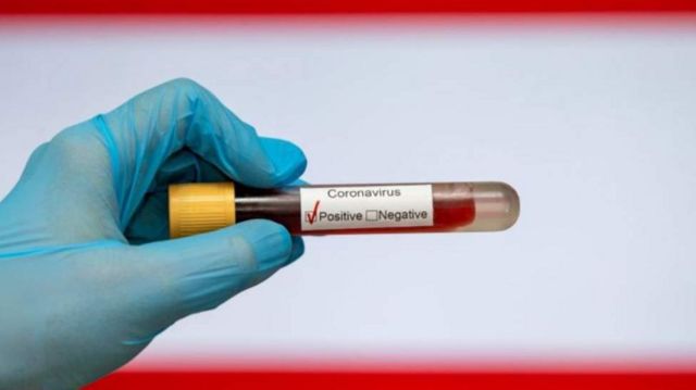 Covid-19 në Kosovë/ Tre të vdekur dhe 53 raste të reja