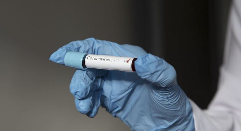 COVID-19 në Maqedoninë e Veriut, 15 viktima dhe 247 raste të reja