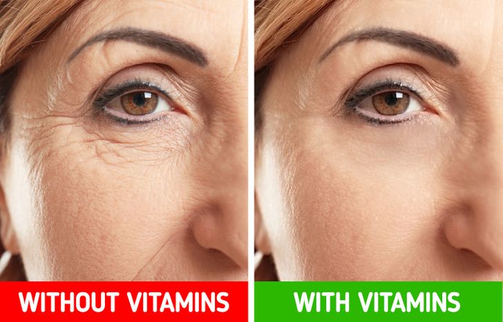 6 faktorë që mund t’i shkaktojnë më shumë rrudha lëkurës suaj