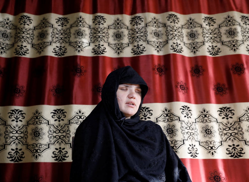 33-vjeçarja sulmohet dhe humb shikimin sepse gjeti punë: Babai më ndiqte dhe…