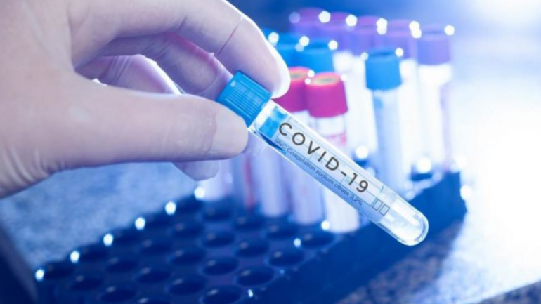 Maqedoni e Veriut, regjistrohen 35 viktima dhe 387 raste të reja me COVID